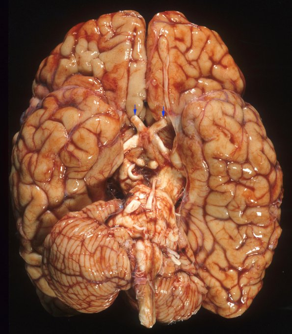 1A1 MS (Case 1) A1 copy