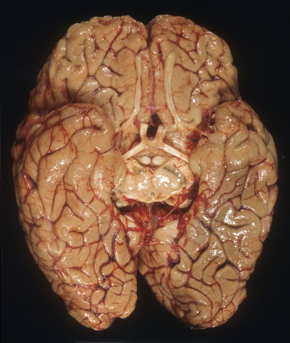 2A1 MS (Case 2) 2