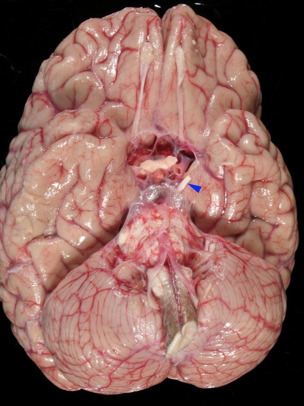 4A1 MS (Case 4)_2 copy