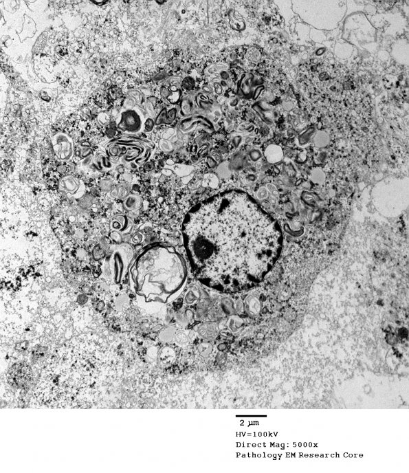 1G1 NMO (Case 1) (R13-153B) EM 041 - Copy