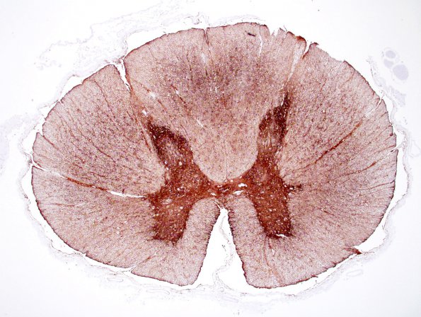 2A1 AQ4 control human spinal cord 2X