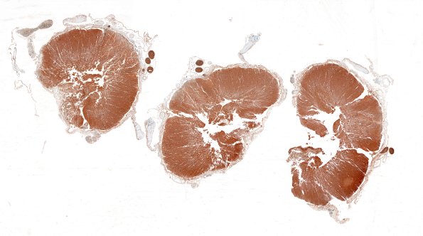 1F1 Neuromyelitis Optica (NMO, Case 1) N12 1 Spinal Cord NF whole mount