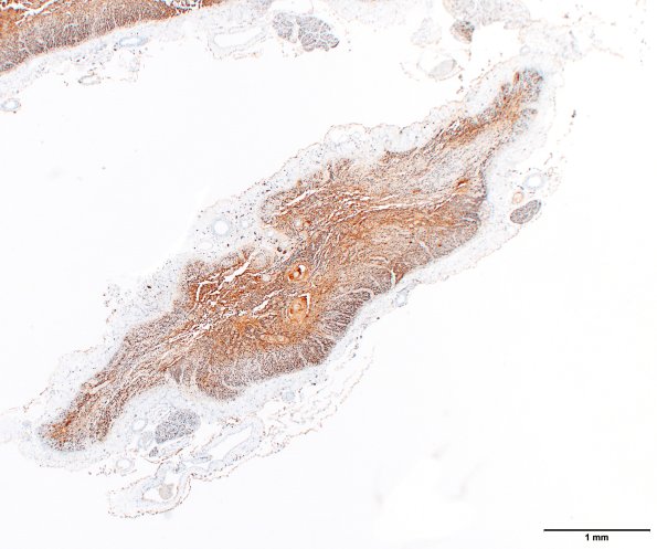 2D1 NMO (Case 2) N11 NF 2X section 2