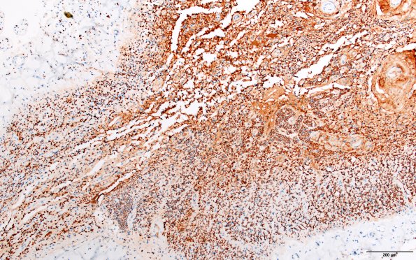 2D2 NMO (Case 2) N11 NF 10X section 2