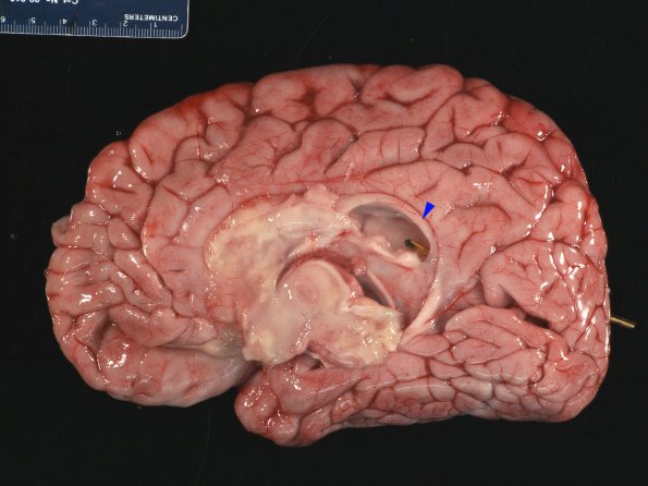 2A2 Alexander's Dz (Case 1) 7 copy