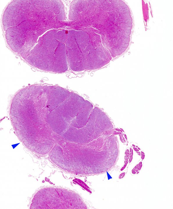 3E1 Alexander Dz (Case 3) N10 H&E whole mount copy