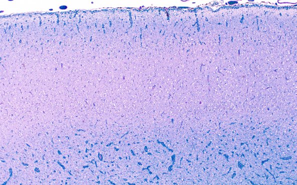 4B6 CGHA (Case 4) Cerebral cortex, little WM  area A LFB-PAS 4X