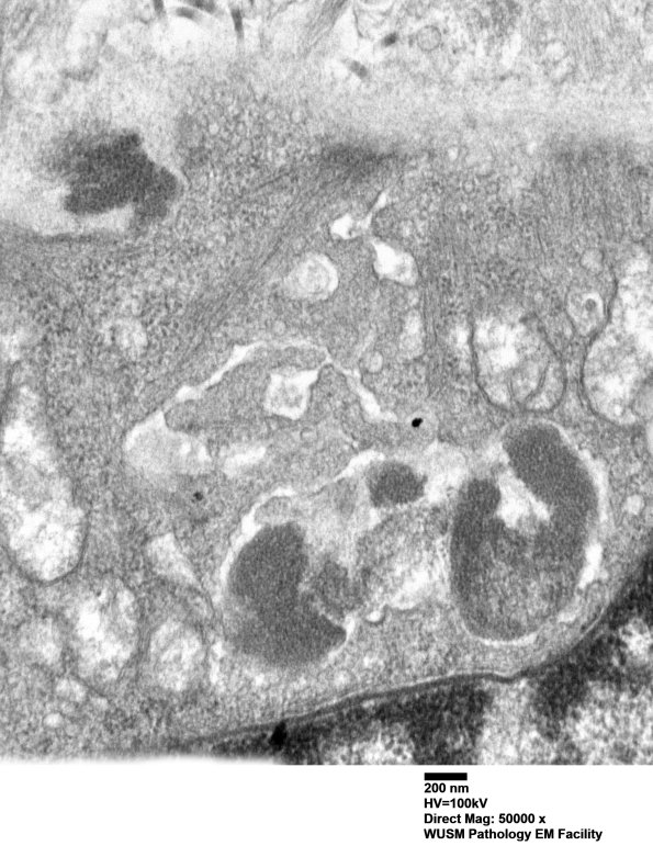 11C2D (Case 11) BlkD skin EM 015 - Copy