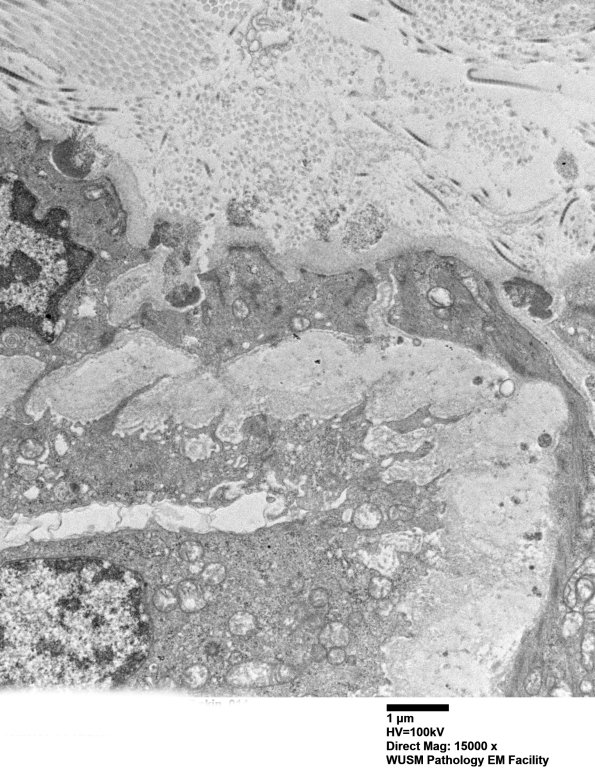 11E5B (Case 11) BlkD skin EM 014 - Copy