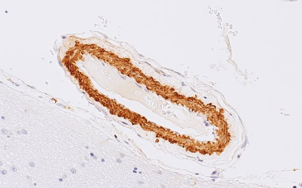 2D2 Normal vessels (Case 11) SMA 40X