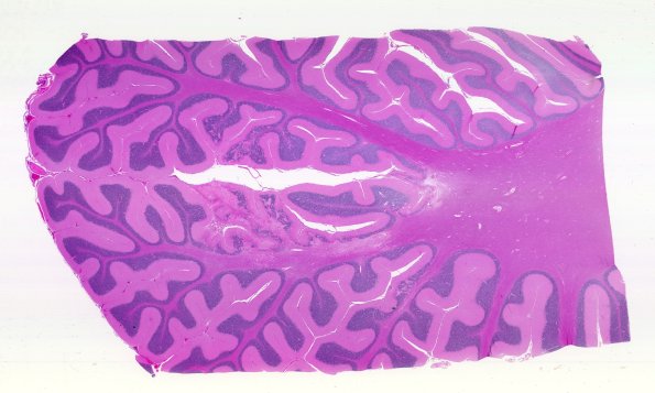 18F1 TREX1 Disease (Case 18 H&E N9