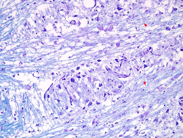 1D4 CPM (Case 1) N7 Area A LFB-PAS 3 copy.jpg