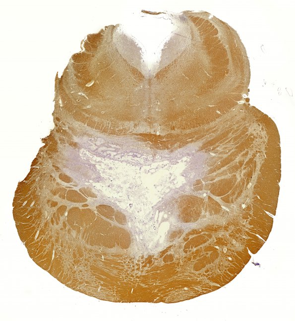 5C3 CPM (Case 5) 2 Proteolipid protein whole mount