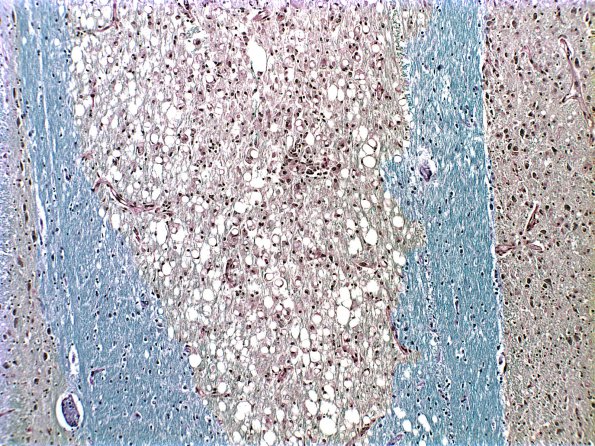 9D1 CPM (Case 9) 1 LFB-PAS part A