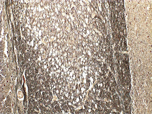 9D2 CPM (Case 9) 1 part B