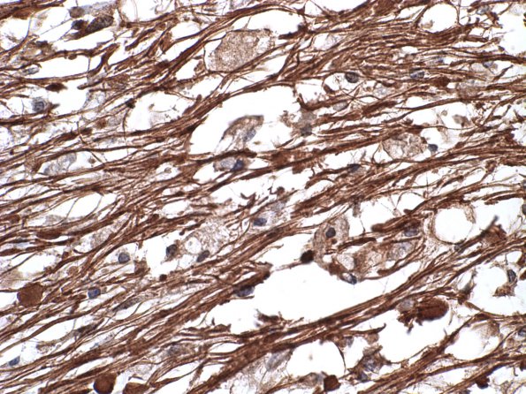 9D4 CPM (Case 9) NF 1