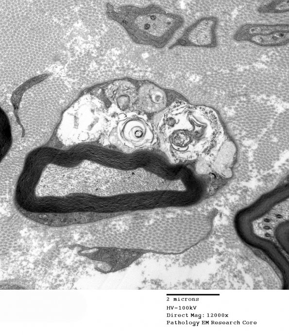 2D1 MLD (Case 2)_014 - Copy