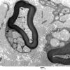 2D2 MLD (Case 2)_033A - Copy