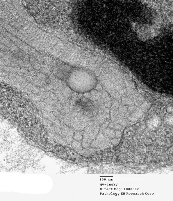 2E10 MLD (Case 2)_009A - Copy