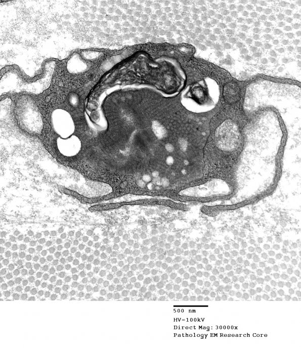 2E2 MLD (Case 2)_015A - Copy