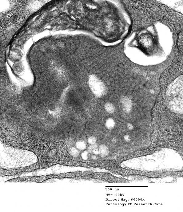 2E3 MLD (Case 2)_016A - Copy