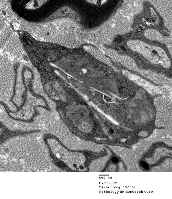 2E6 MLD (Case 2)_050A - Copy