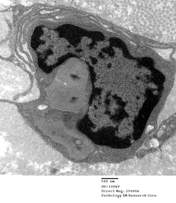 2E8 MLD (Case 2)_006A - Copy