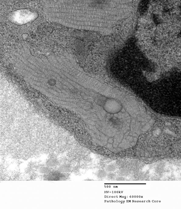 2E9 MLD (Case 2)_007 - Copy