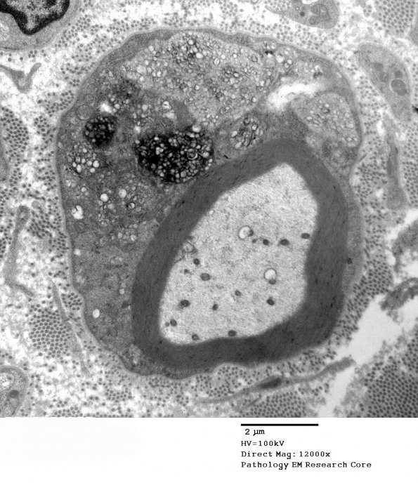 4B MLD (Case 4) EM 048 - Copy