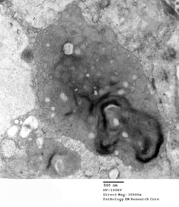 4C3 MLD (Case 4) EM 052 - Copy - Copy