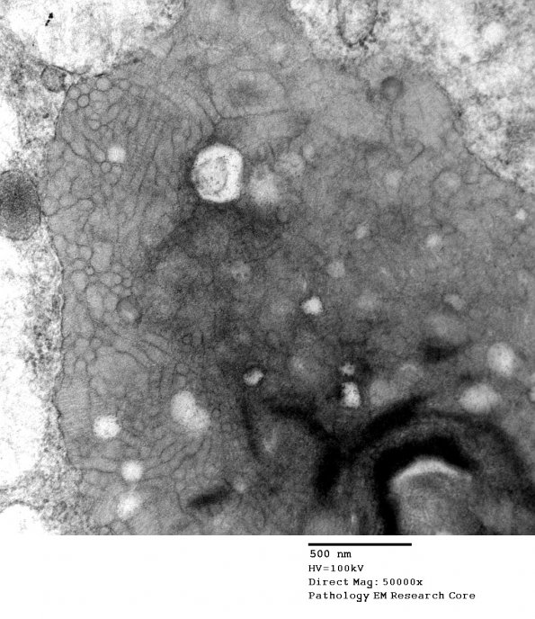 4C4 MLD (Case 4) EM 053 - Copy - Copy