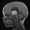 1A2 Cranio Rx 3 yr prior Case 1) )T1 1 - Copy