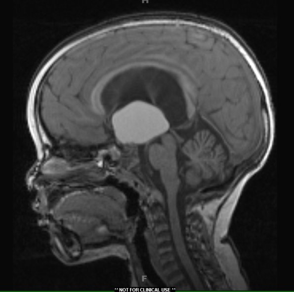 1A2 Cranio Rx 3 yr prior Case 1) )T1 1 - Copy