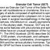 0A Granular Cell Tumor - Text