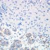 1H4 Granular Cell Tumor (Case 1) SYN 2A