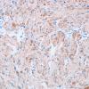 5C5 Granular Cell Tumor, colon polyp (Case 5) S100 4A