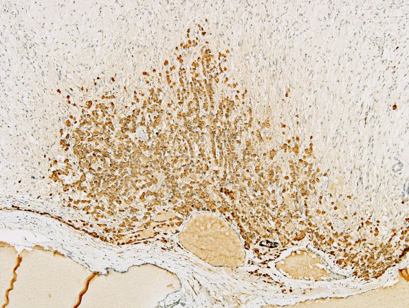 23A2 PIT Basophil inv (Case 23) ACTH 10X.jpg