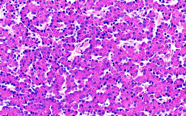 6A5 Pituitary, normal basophil invasion (Case 6) H&E 40X