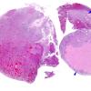 10A1 Pituitary Adenoma (Zoo Case) H&E whole mount A copy