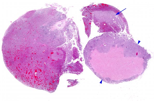 10A1 Pituitary Adenoma (Zoo Case) H&E whole mount A copy