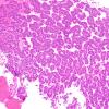 Histologic Patterns