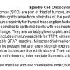 0A Spindle Cell Oncocytoma (SCO) - Text