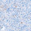 1J Spindle cell Oncocytoma (Case 1) SYN 1