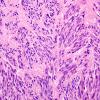 3A4 Spindle cell oncocytoma (Case 3) H&E 3