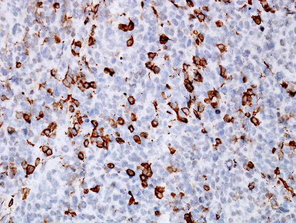 1F2 ATRT (Case 1) SMA 2.jpg