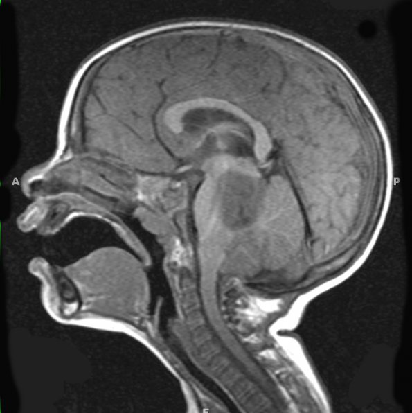 2A1 ETANTR (Case 2) T1 1 - Copy