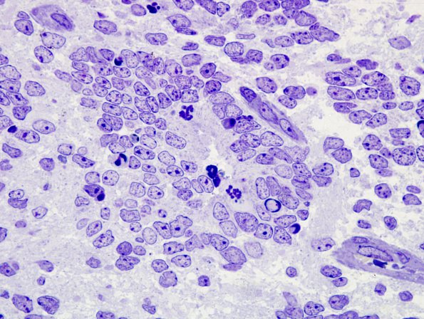 2E3 ETANTR (Case 2) Plastic 1