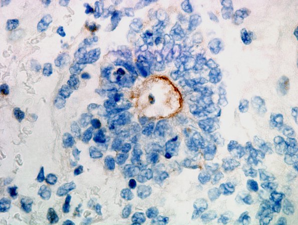 3C1 ETANTR (Case 3) D2-40 3.jpg