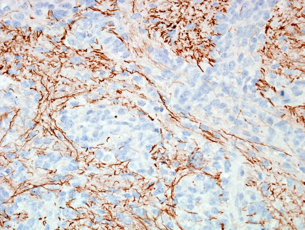 4C5 ETANTR (Case 4) NF 6.jpg