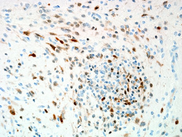 4D1 ETANTR (Case 4) NeuN 6 20X.jpg